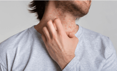 ما وراء قناع الاكتئاب المبتسم.. "الوجه المظلم للضحك" 4 الأعراض الجسدية للاكتئاب